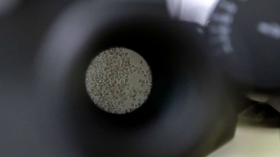 T-ćelije mogu se zadržati u telu godinama nakon što infekcija prođe, obezbeđujući tako dugotrajnu memoriju imunskom sistemu