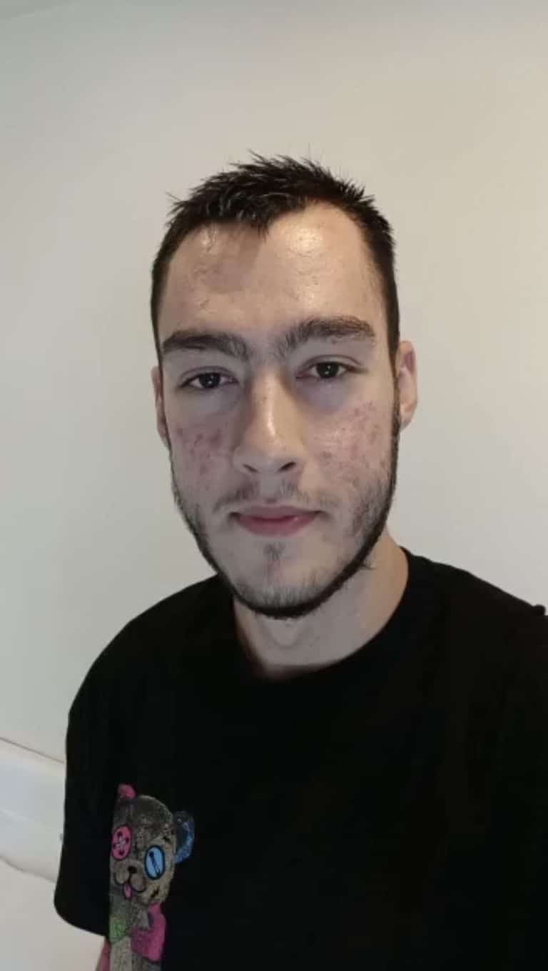 Tarik Malmudirović uspešno operisan