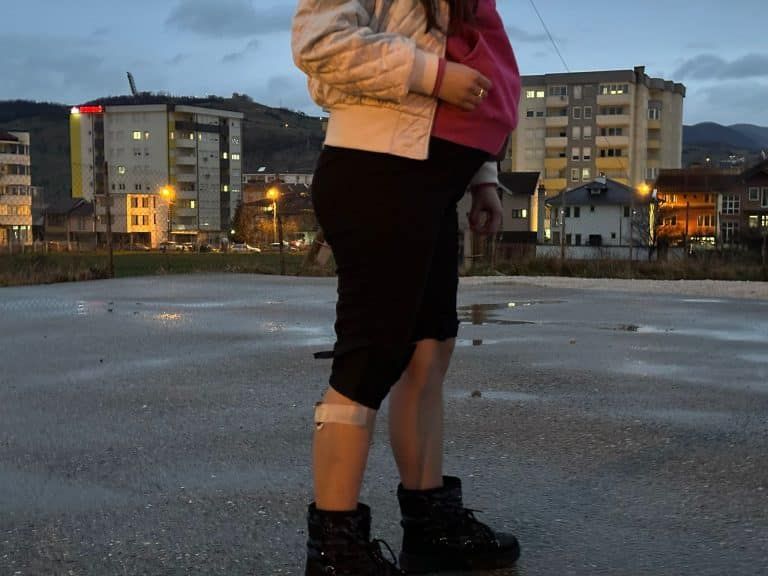 Čopor pasa izujedao trudnicu u Novom Pazaru (video)