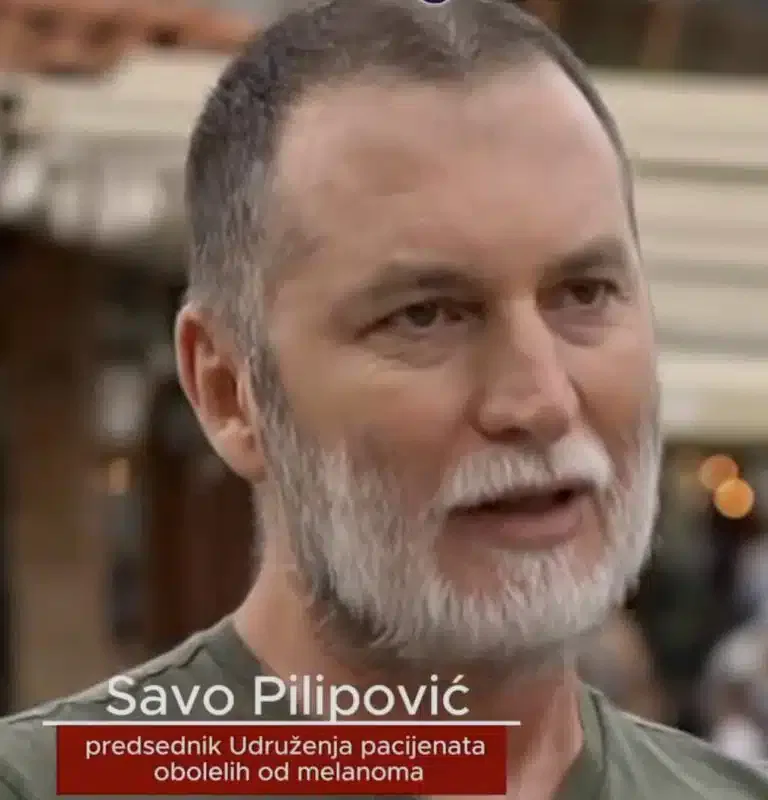 Samo jedno izlaganje solarijumu može dovesti do raka