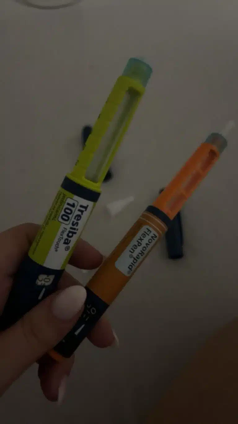 ,,Ja se čak i ne sećam svog života pre dijabetesa” / Budimo jači od šećera (VIDEO)