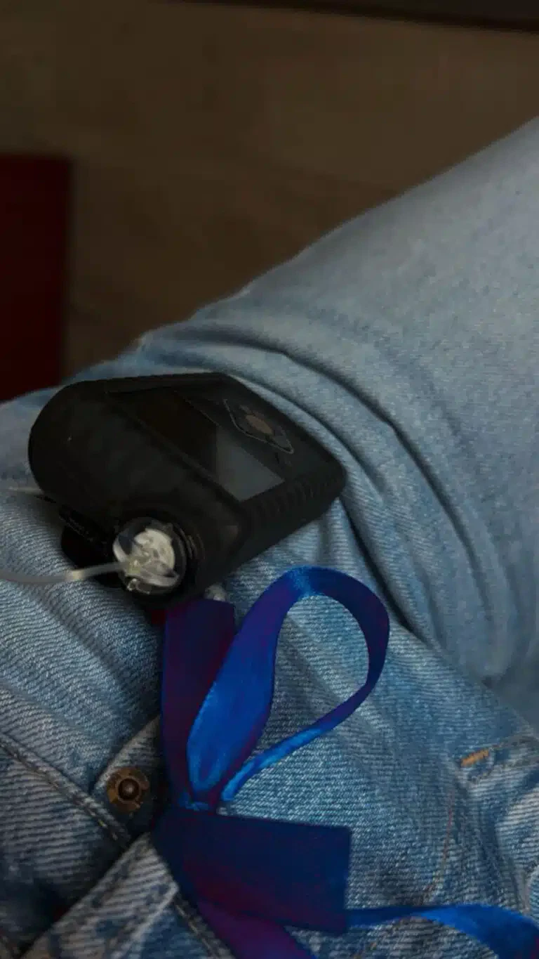 „U vrtićima nema pravila za decu sa dijabetesom, roditelji traže promene“ /Budimo jači od dijabetesa (VIDEO)